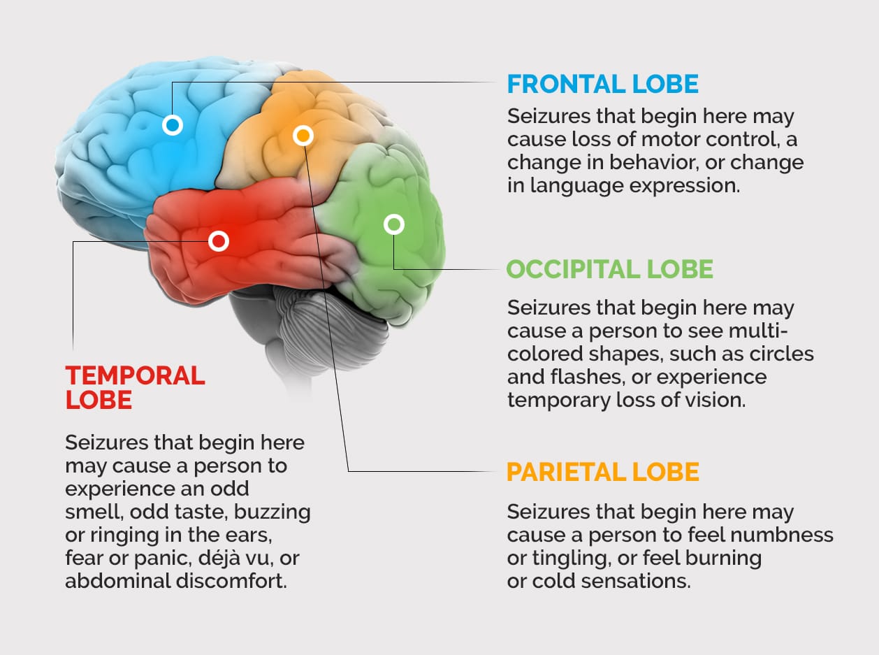 Understanding Refractory Epilepsy: Beyond the Seizures